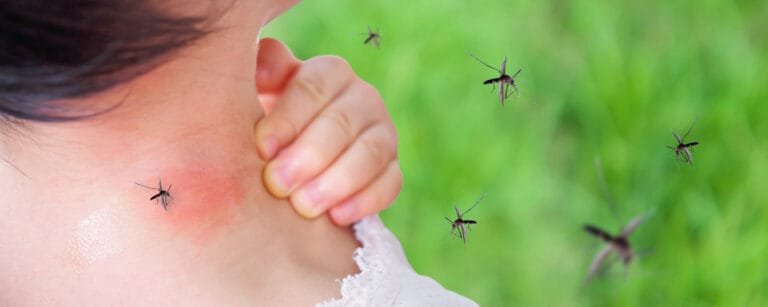 Mosquitoes In Ontario Mosquito bite bug bite